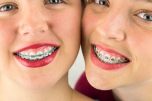 twins happy with the results they got after going to chester county orthodontics specialists