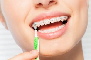 brushing with braces Swiatek